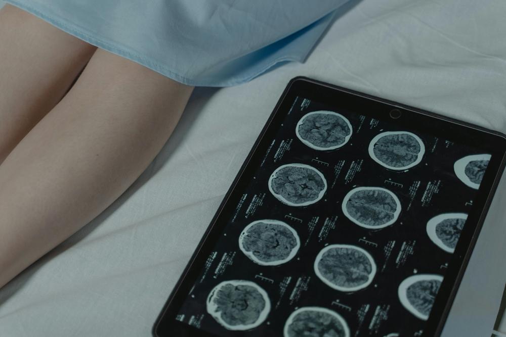 brain symptoms